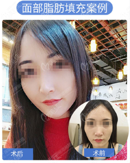 苹果七可以玩黎明吗手游,苹果七可以玩黎明吗手游版